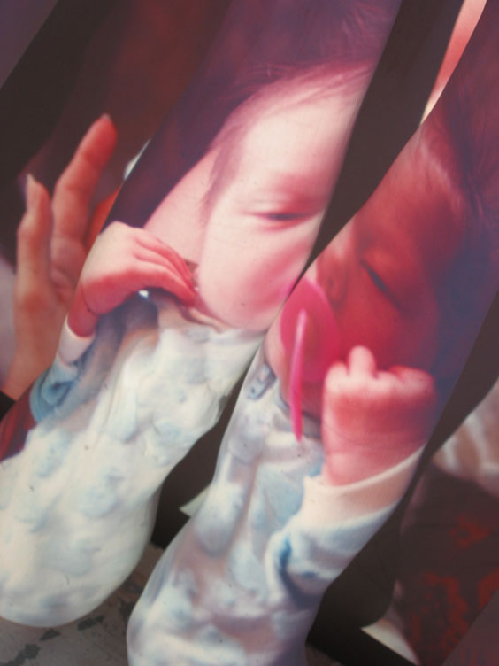 Neonatal_13