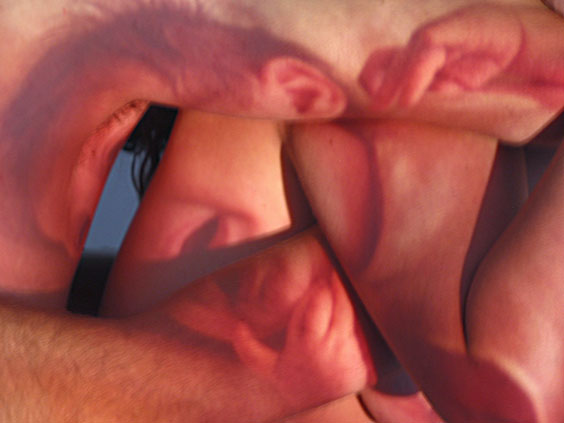 Neonatal_3