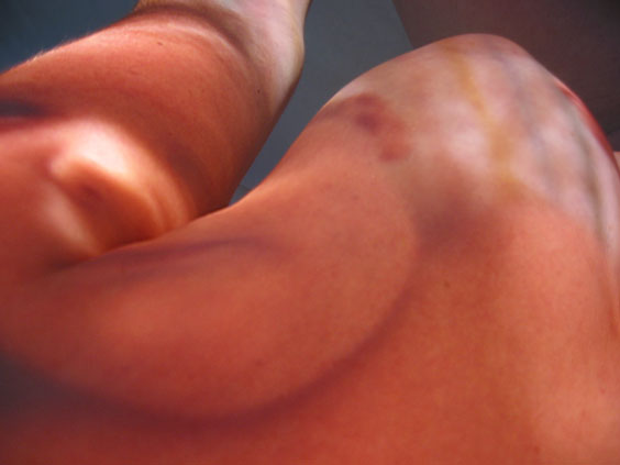 Neonatal_9